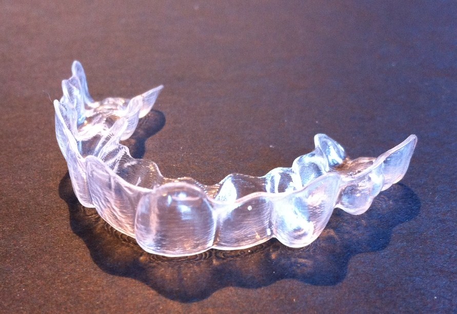 Clear aligner tray held up to show its shape