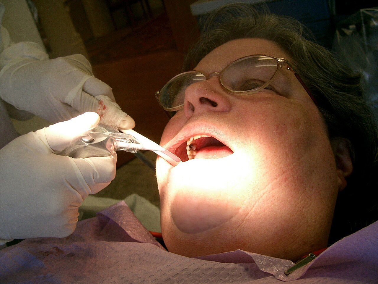 Dental hygienist performing a professional cleaning